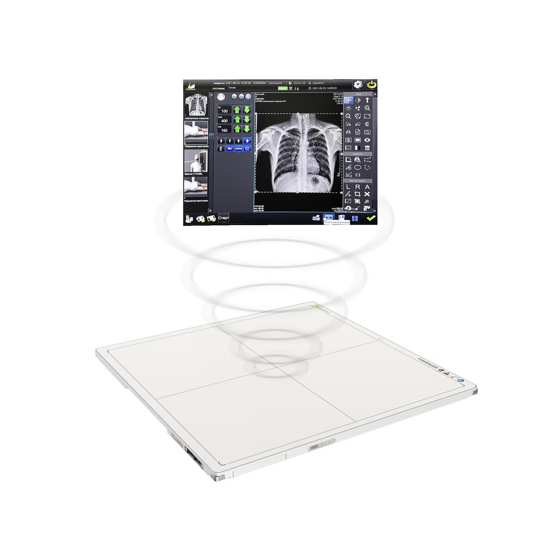 Аппарат цифровой рентгенографии New Oriental 1000N2s — изображение 2